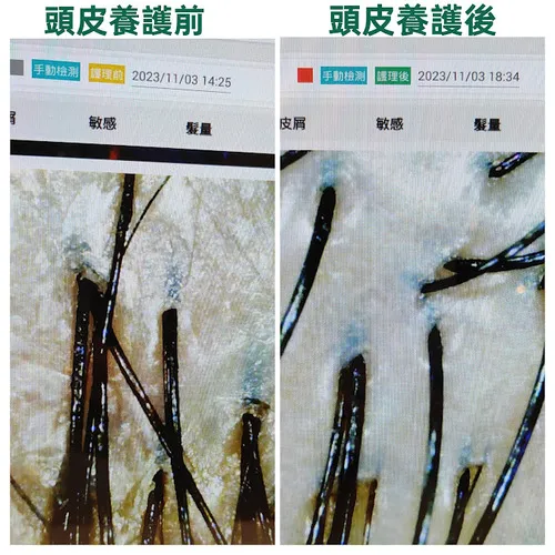 頭皮SPA與專業頭皮保養的深層淨化哲學