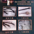 脂漏性頭皮的溫和保養指南與日常對策