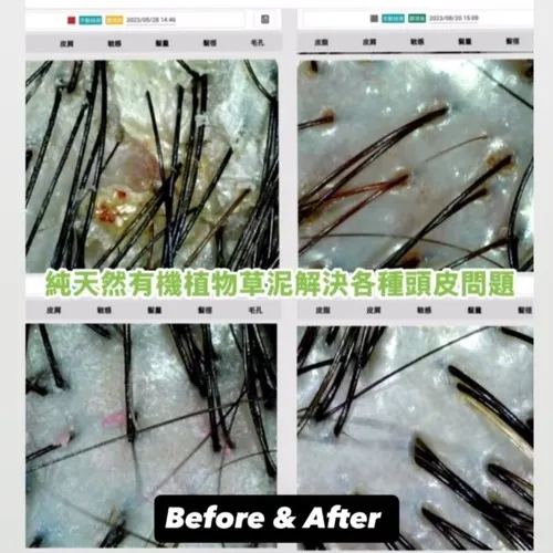 歲月不留痕:解析髮絲變化的奧秘與植萃養護哲學