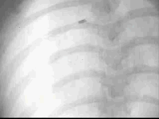 老鼠心臟的冠狀動脈影像