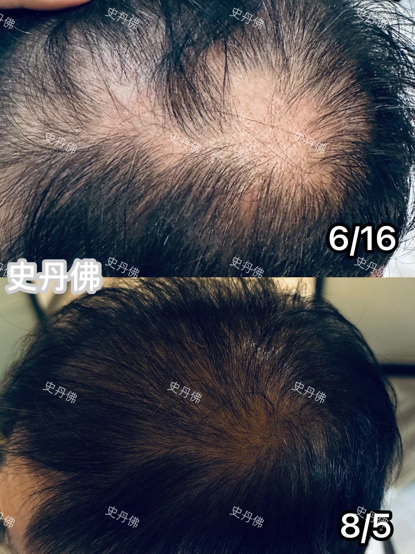 關於史丹佛健3