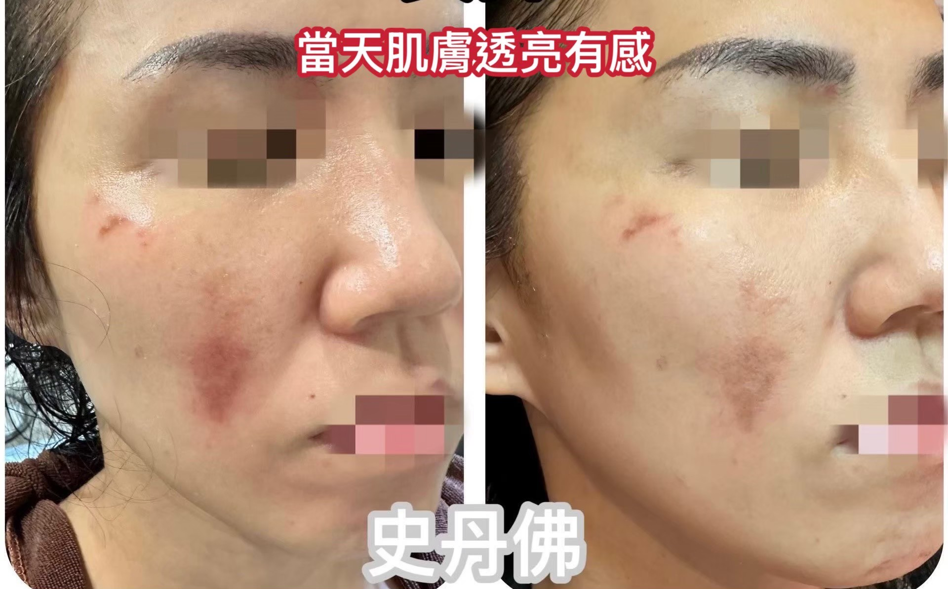 關於史丹佛健4