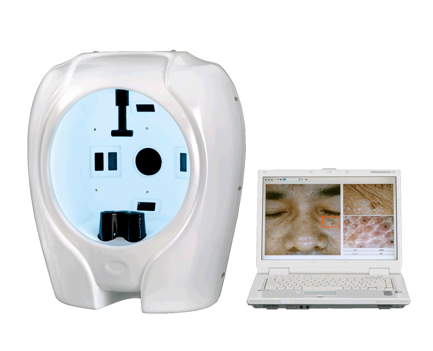 肌膚監測儀  面部皮膚分析儀