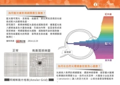 CCFL冷陰極燈管可預防眼睛黃斑部病變