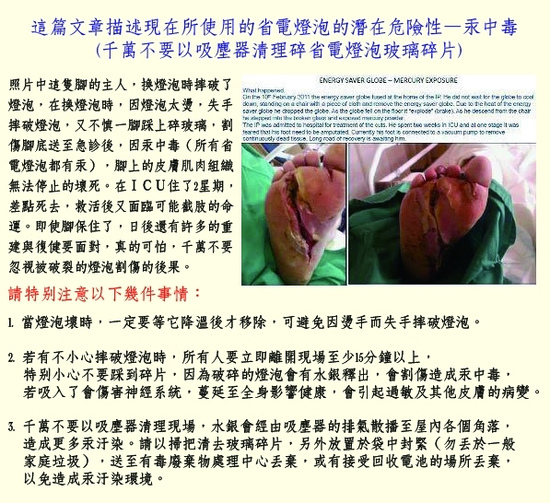 省電燈泡的潛在危險性非常重要請仔細看一看！