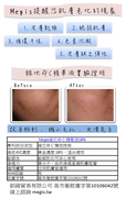 維他命C精華液18%