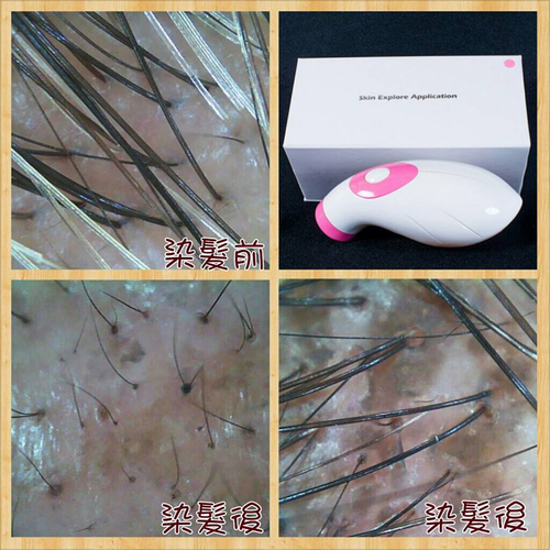 頭皮檢視圖