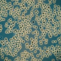 治療H1N1最好的方法就是&rdquo;預防&rdquo;